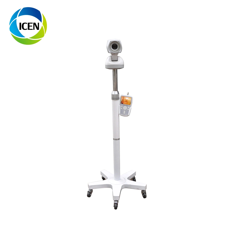 In-G9800A Medical Equipment Colposcope Digital Imaging System Specifications White LED (مواصفات نظام التصوير الرقمي في G9800A) مصدر الضوء لمنظار كولبوسكوب