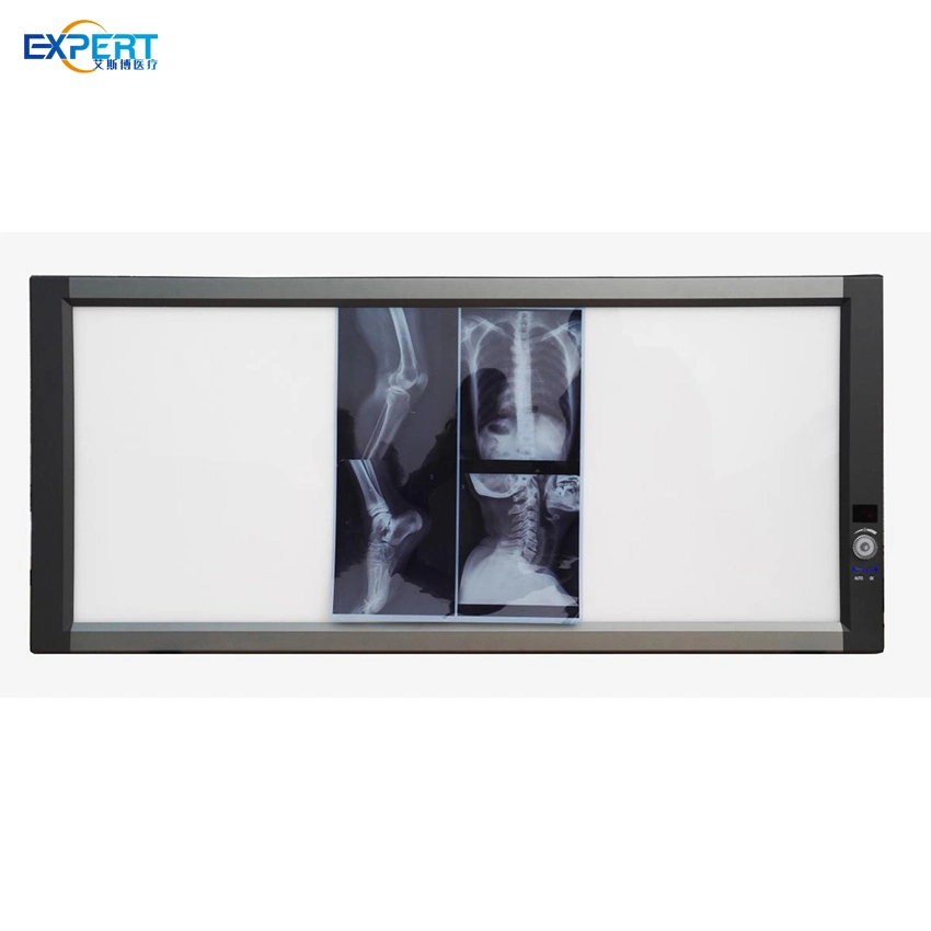 Medical Double Union Hospital Xray Single View Dental X Ray Film Scanner Box