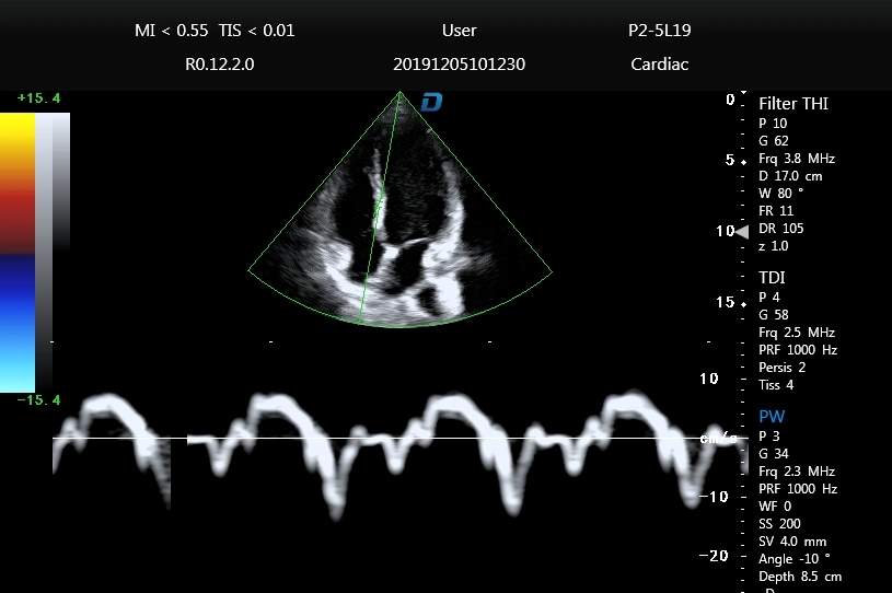 DW-P8 Echocardiography Heart Ultrasound General pw CW Thi M-Mode