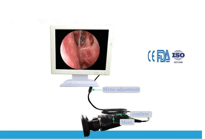 Full HD portátil del Sistema de cámara de Endoscopia Endoscopia la unidad de Cámara con fuente de luz LED Monitor médico y HD Recorder