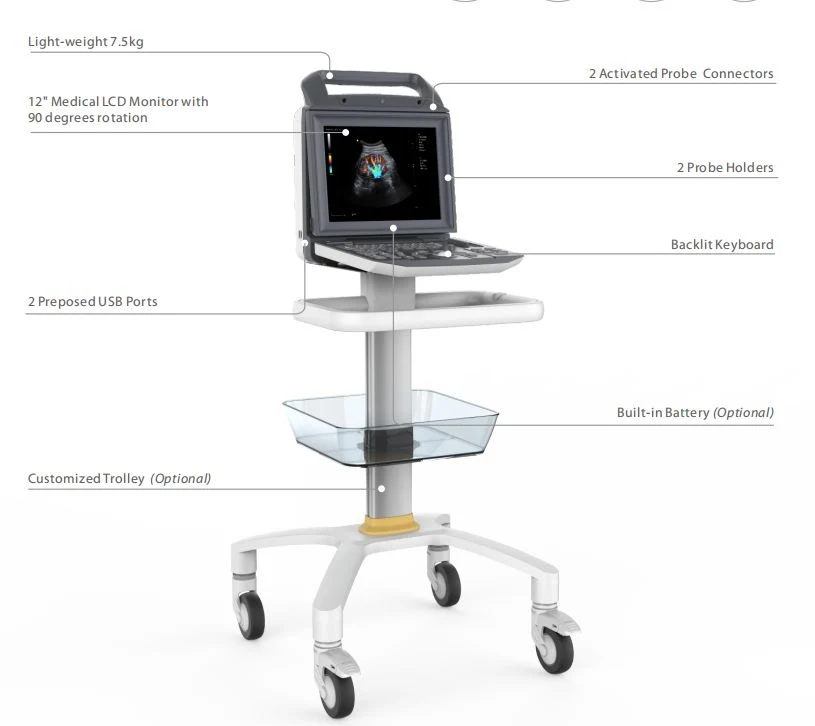 Antes de Cardiología Echographe Echo totalmente digital portátil de ultrasonido escáner Doppler Color con buen precio.