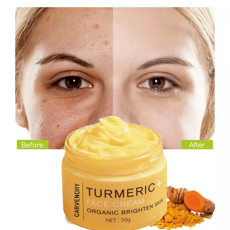 Hidratante de alta cúrcuma quedarse hasta tarde eliminar el acné Crema reafirmante Crema de cara