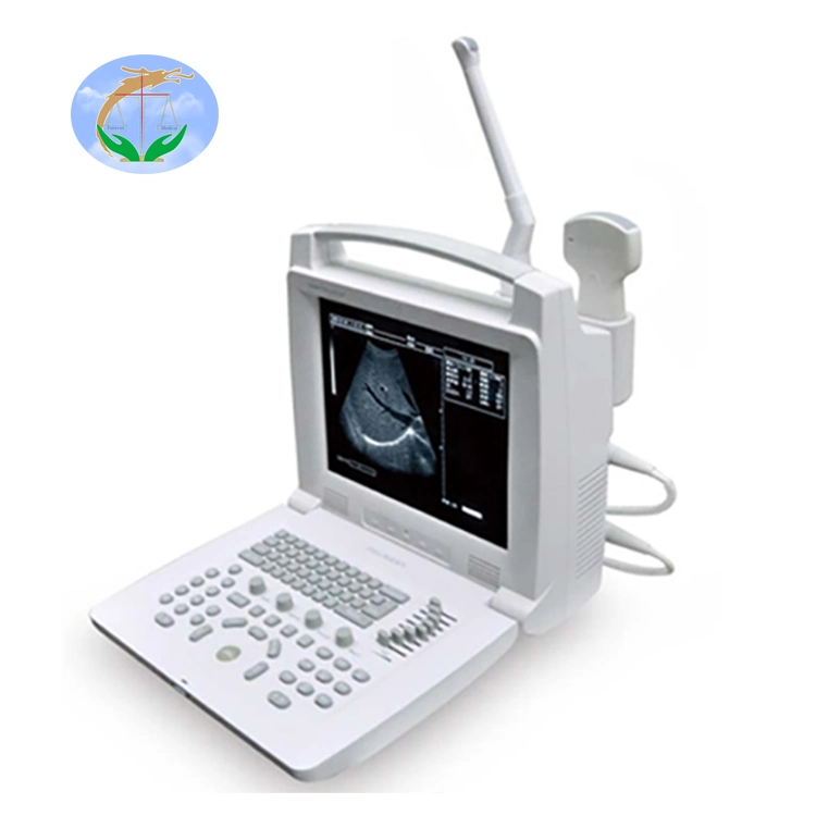 Portable Digital Ultrasound Scanner Medical Equipment