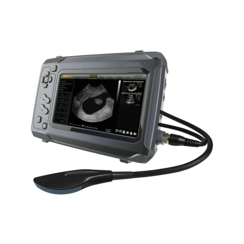 Hot Sale S6 Touch Screen Sonar Veterinary Ultrasound Scanner Price