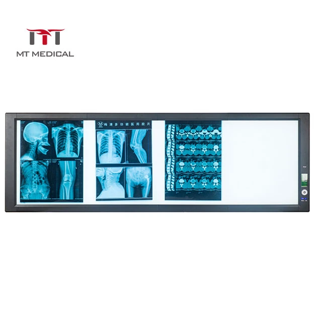 Light-Adjustable Medical X Ray Film Viewer LED Screen