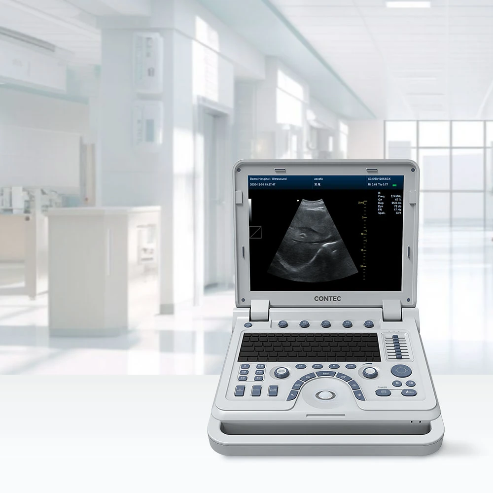 Contec Cms1700A Convex Array Extended Imaging Online Technical Support Ultrasound Machine