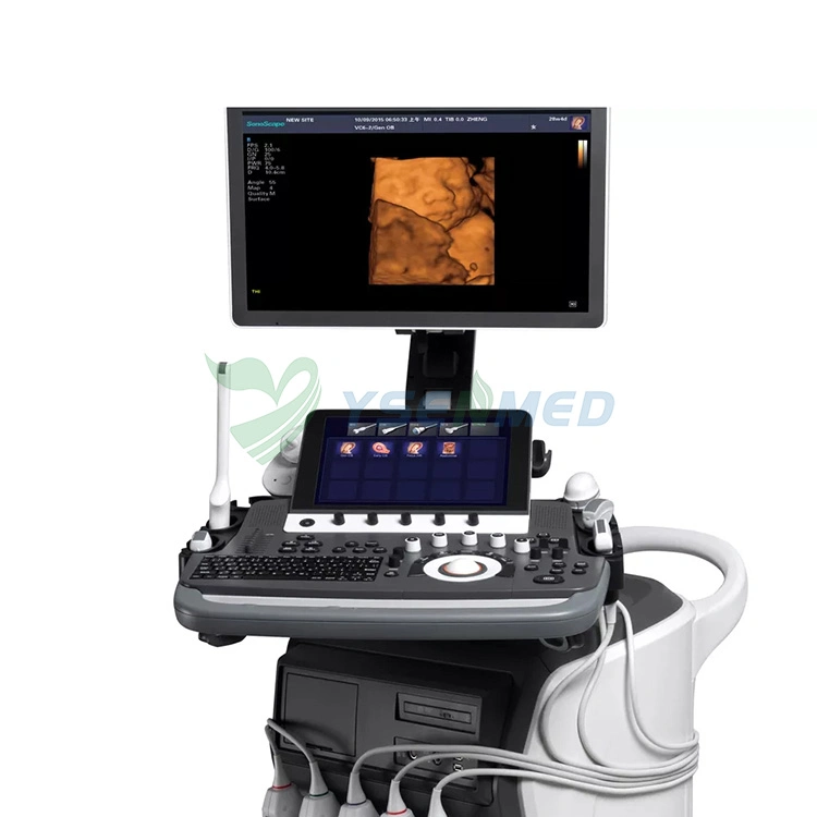 Sonoscape S50 Elite Trolley 3D/4D Farbdoppler Ultraschall-Maschine Medizin Ausrüstung