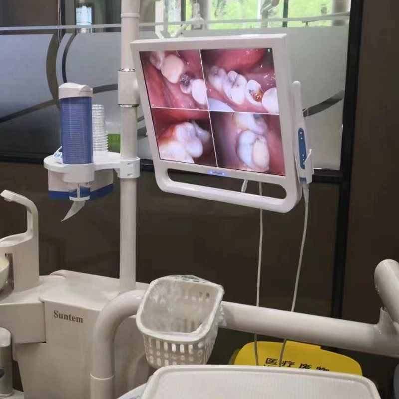 17 Inch Monitor and Intraoral Camera Unit for Dental Chair