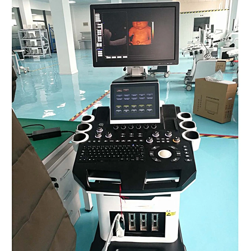 Hc-A014A Medical 4D Trolley Color Doppler Ultrasound Scanner with Double Screen