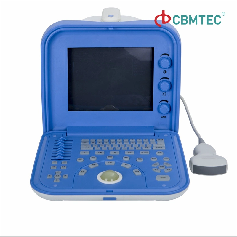 Factoty Wholesale/Supplier High quality/High cost performance Portable Ultrasound Scanner