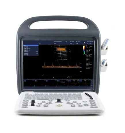 Factory Supply Exp-5600 Medicine Equipment Ultrasound Scanner for Animal Pregnancy Vet Laptops Ultrasound Scanner