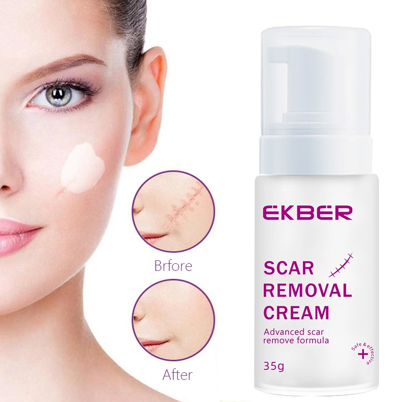 OEM Bulk Pure Natural facial eficaz remoção de cicatrizes creme Anti Acne cuidados da pele