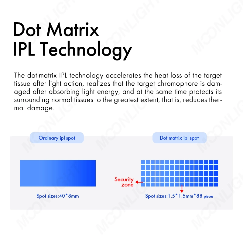 2 en 1 IPL Opt E-Light piel de luz pulsada intensa Rejuvenecimiento pigmento Diodo de la cerca Eliminación de Cabello láser