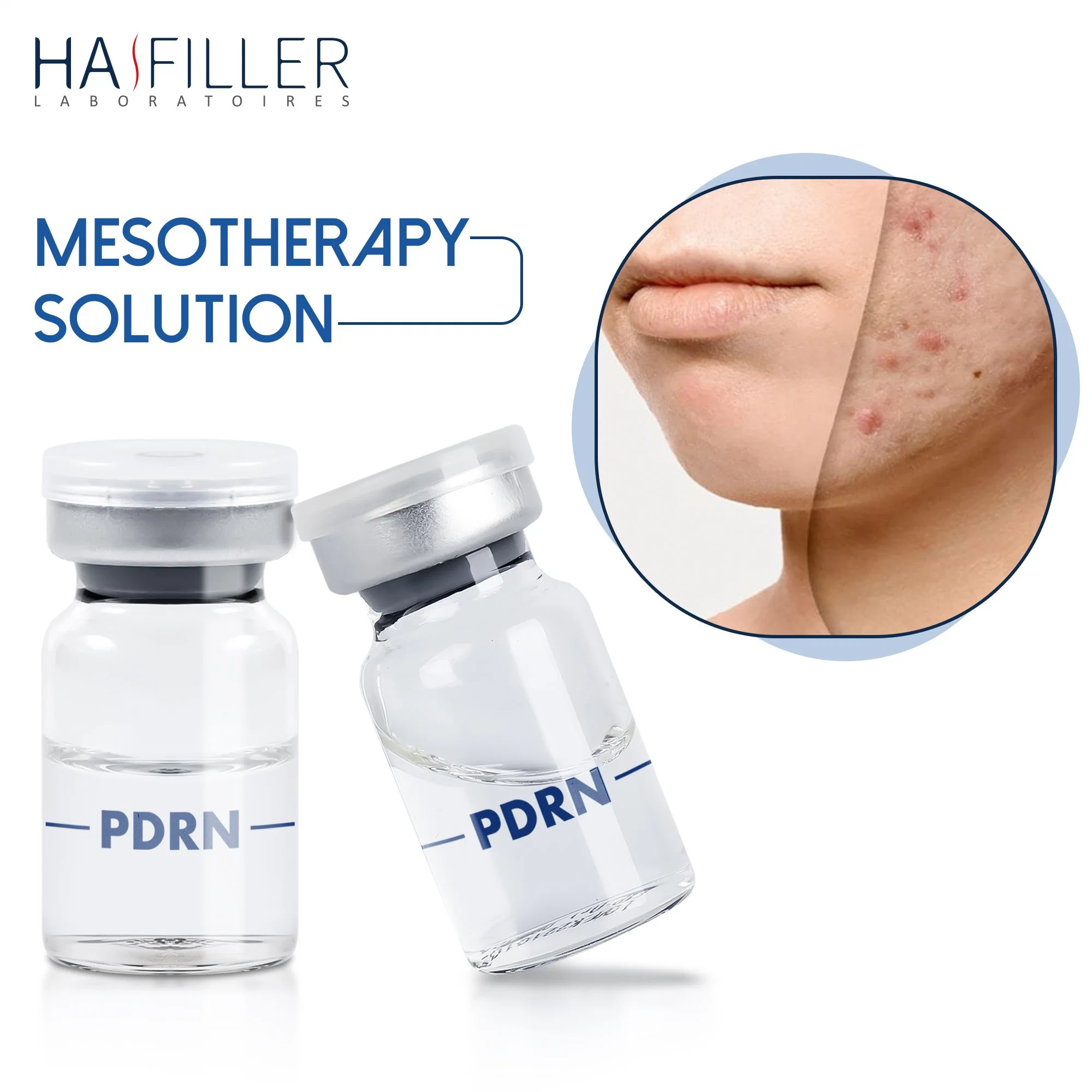 Venta caliente 6 ampolla 3ml Hidratante Piel Piel rejuvenecimiento de la inyección de solución de salmón Pdrn Booster mesoterapia