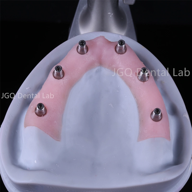 Dental Implant Hybrid Full Jaw Screwed Zirconium Crowns and Bridge From China