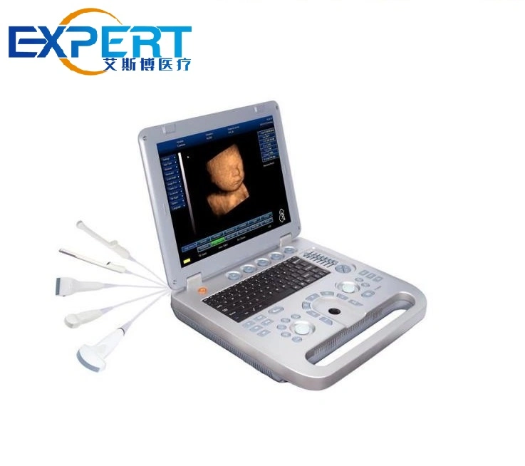 ISO CE Approved Digital Portable 2D 4D Color Doppler Echo Machine Ultrasound Scanner