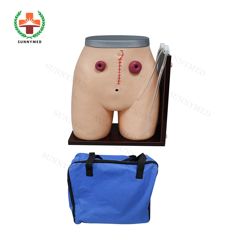 Sy-N059 maniquí de entrenamiento de Enfermería de buena calidad ostomía modelo de enfermería