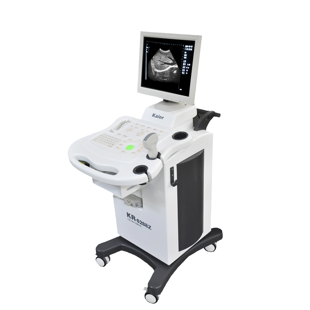 Ultrabajo precio Cart Ultrasound en blanco y negro con Convex Array Sonda