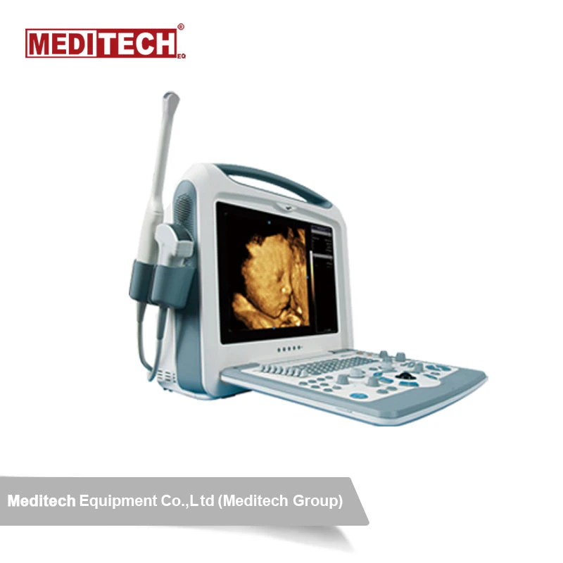 Amazing Color Portable Ultrasound Scanner with Multi Frequency Convex Probe Standard