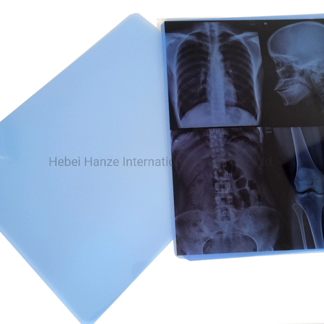 Película médica de raios X azul para imagiologia a seco a jato de tinta A4 14 * 17 para Impressoras