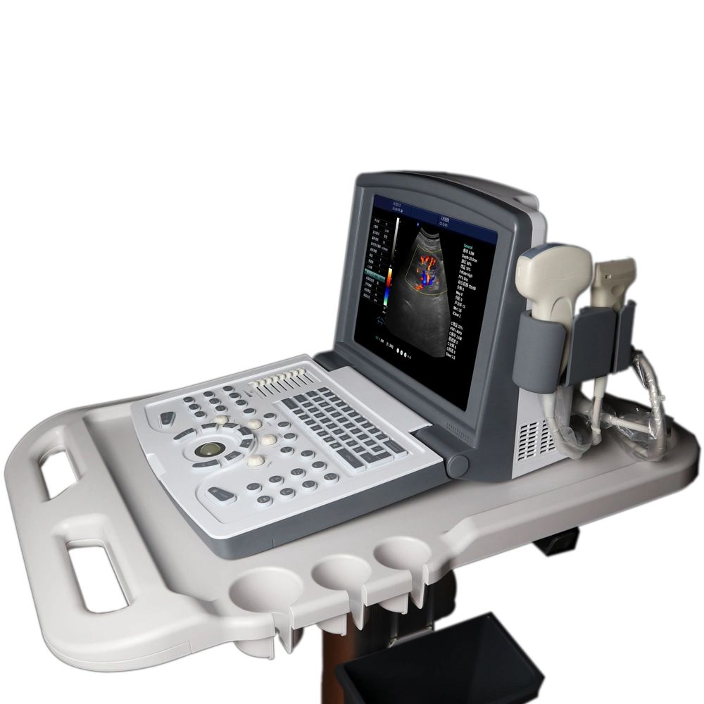 Горячий Icen продавать портативный компьютер 2D-Цифровой ветеринарных цвет ультразвукового сканера .
