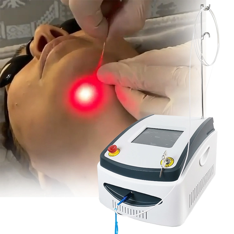 Máquina de liposucción con láser, tratamiento de lipólisis láser, CE médico, Fiberlift, cirugía plástica con láser.