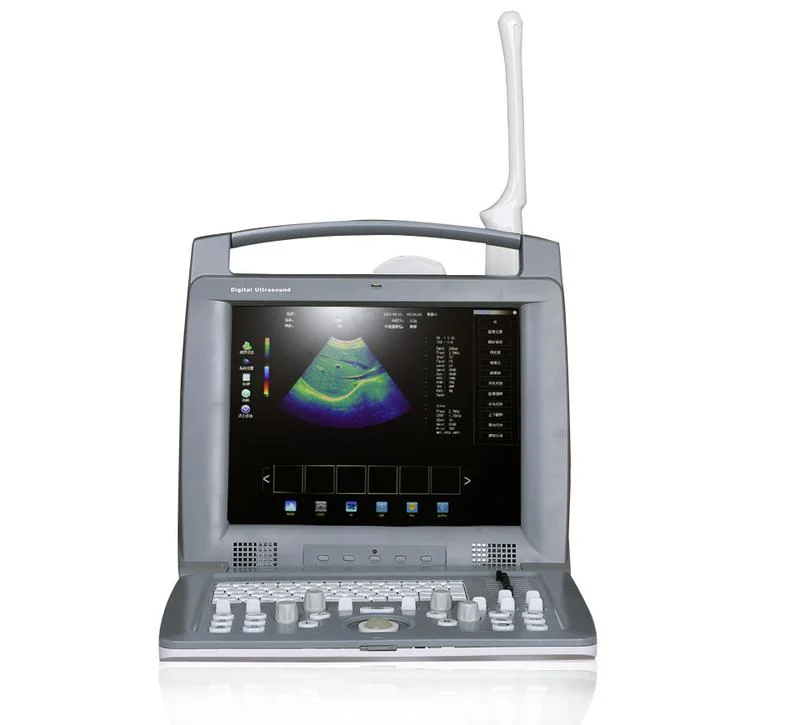 جهاز طبي محمول ثلاثي الأبعاد بالألوان دوبلر الموجات فوق الصوتية تصوير الانقباضية/الماسح الضوئي/الجهاز