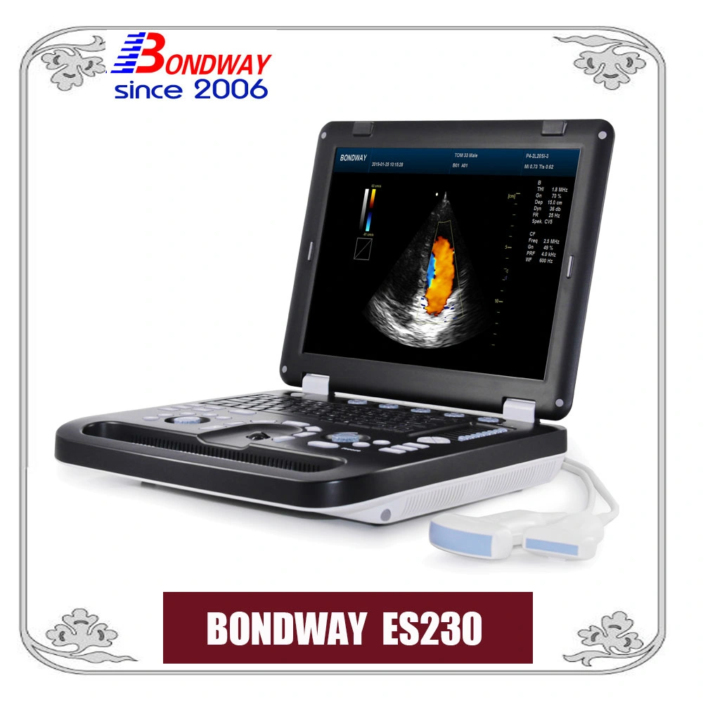 Full Digital Portable Color Doppler Ultrasound System, Sonography, 4D Ultrasound, 3D Ultrasonic