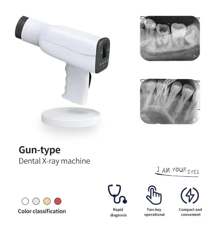 Unidade de imagem de raios X digitais Dental Portátil de raios X dentários Equipamento do sistema de máquinas Mobile Dental RVG Sensor Câmara de raios X