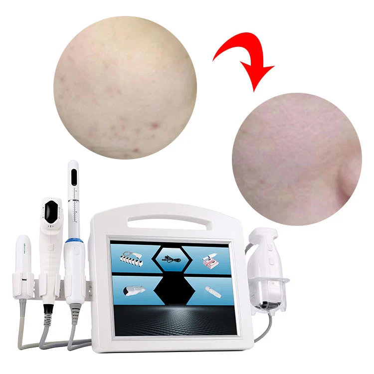 Portable 5 in 1 2023 Beliebte Wrinkle Removal Weight Loss Gerät Fett Brennende Haut Straffung Abnehmen Beauty Machine