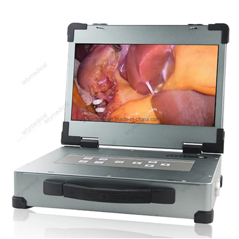 Factory Portable Medical Endoscopy Camera System with Light Source Portable Endoscopy Unit for Gynescology Urology Ent Orthopedics