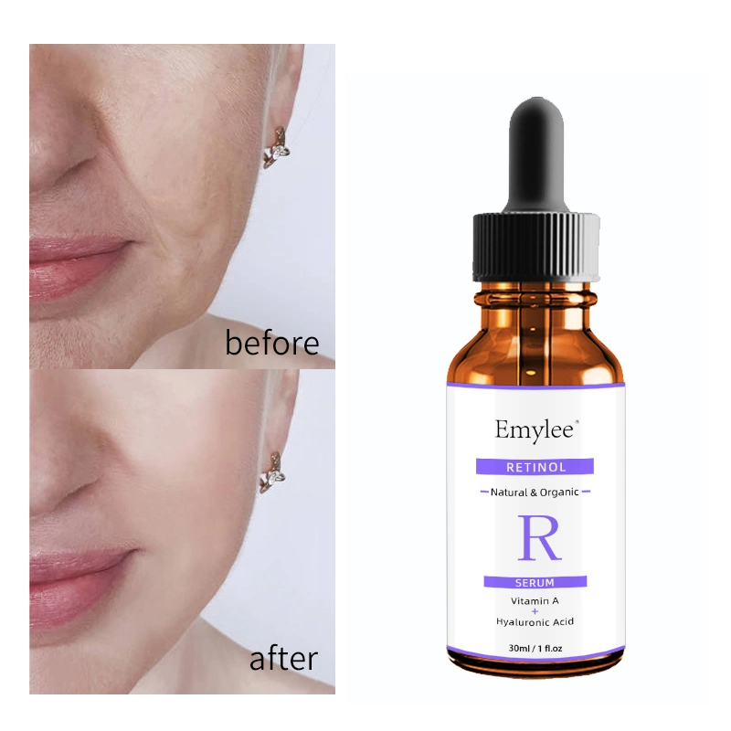 Private Label OEM Skin Care Anti Aging Wrinkle Brightening Hyaluronic Acid + Vitamin E Face 2.5% Retinol Serum