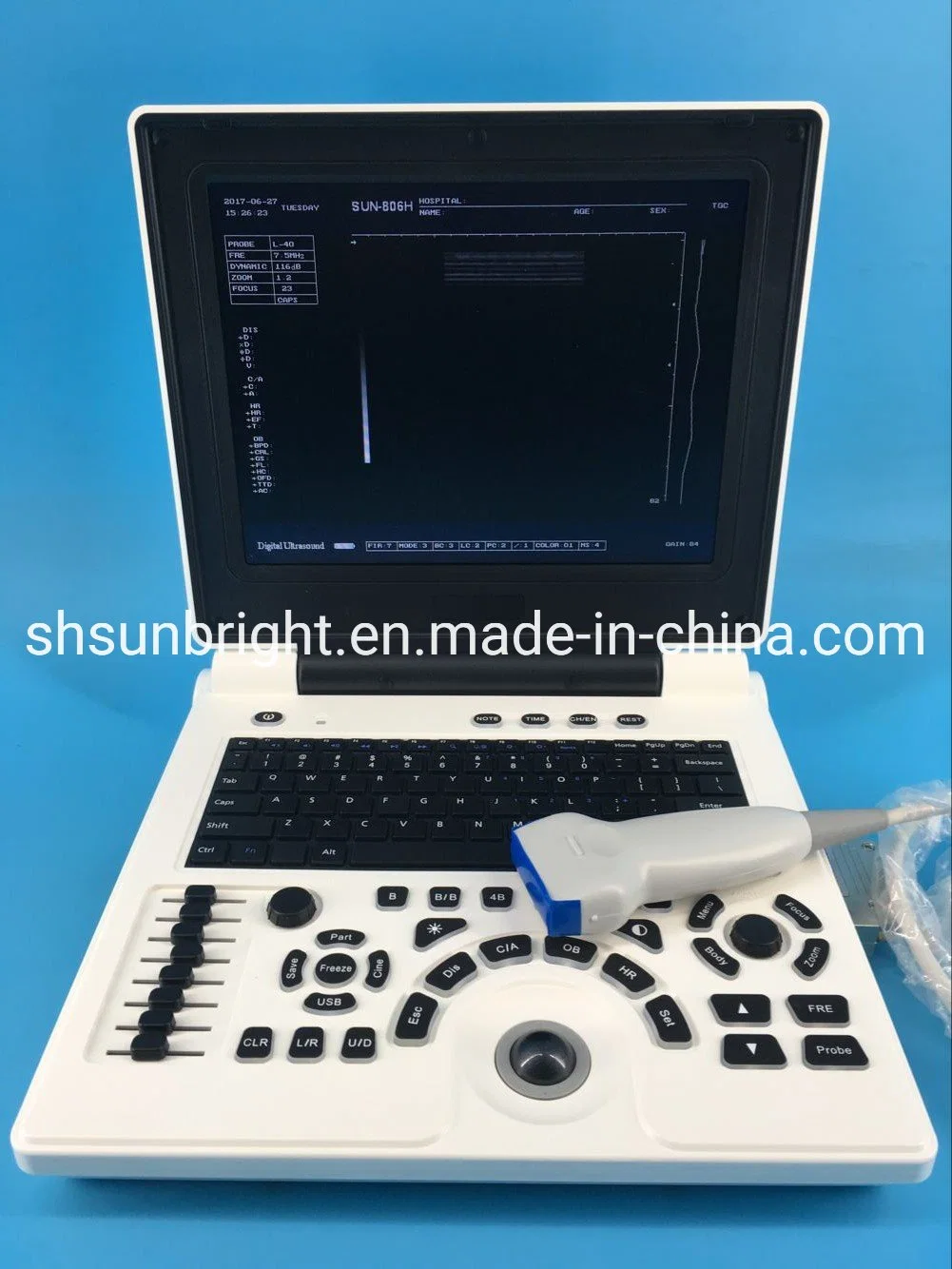 Sun-806h Notebook 2 Probe Connectors Ultrasound Laptop Ultrasound Scanner