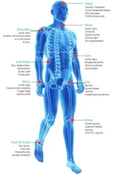 معدات المعالجة الفيزيائية بالليزر Pain 4 من الفئة 4 ذات كثافة عالية 810 نانومتر/980 نانومتر/1064 نانومتر جهاز الليزر لعلاج الألم والعلاج الطبيعي