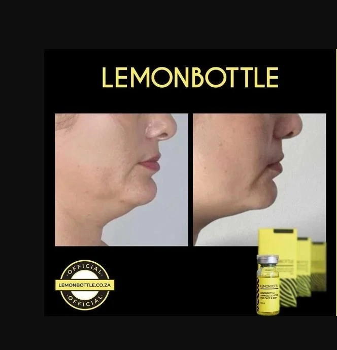 Lemon Bottle The Leading Fat Dissolving Product Lemon Bottle Fat Dissolving Weight Loss Kybella Kabelline Lipo Lab V-Line Kybella