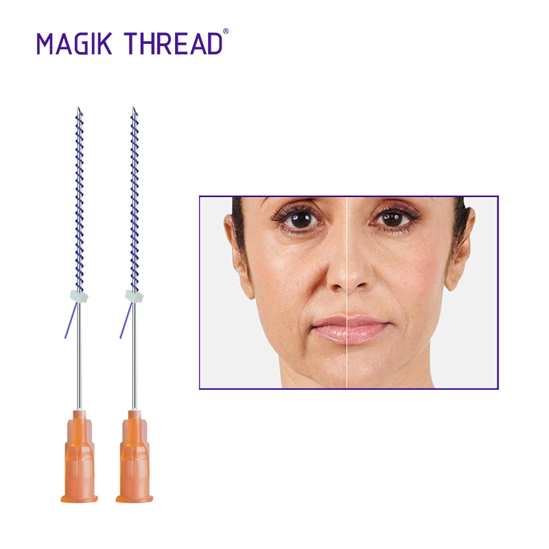 Magik Thread Medical Products Tornado Screw Pdo Thread for Face Thread Lift