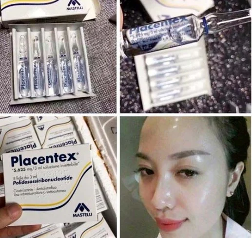 Skin Structure Placentex Skin Rejuvenation 5.625mg/3ml Injectable Dermal Fillers Facial Repair Salmon Needle, Auxiliary Kinetic Energy Water Needle