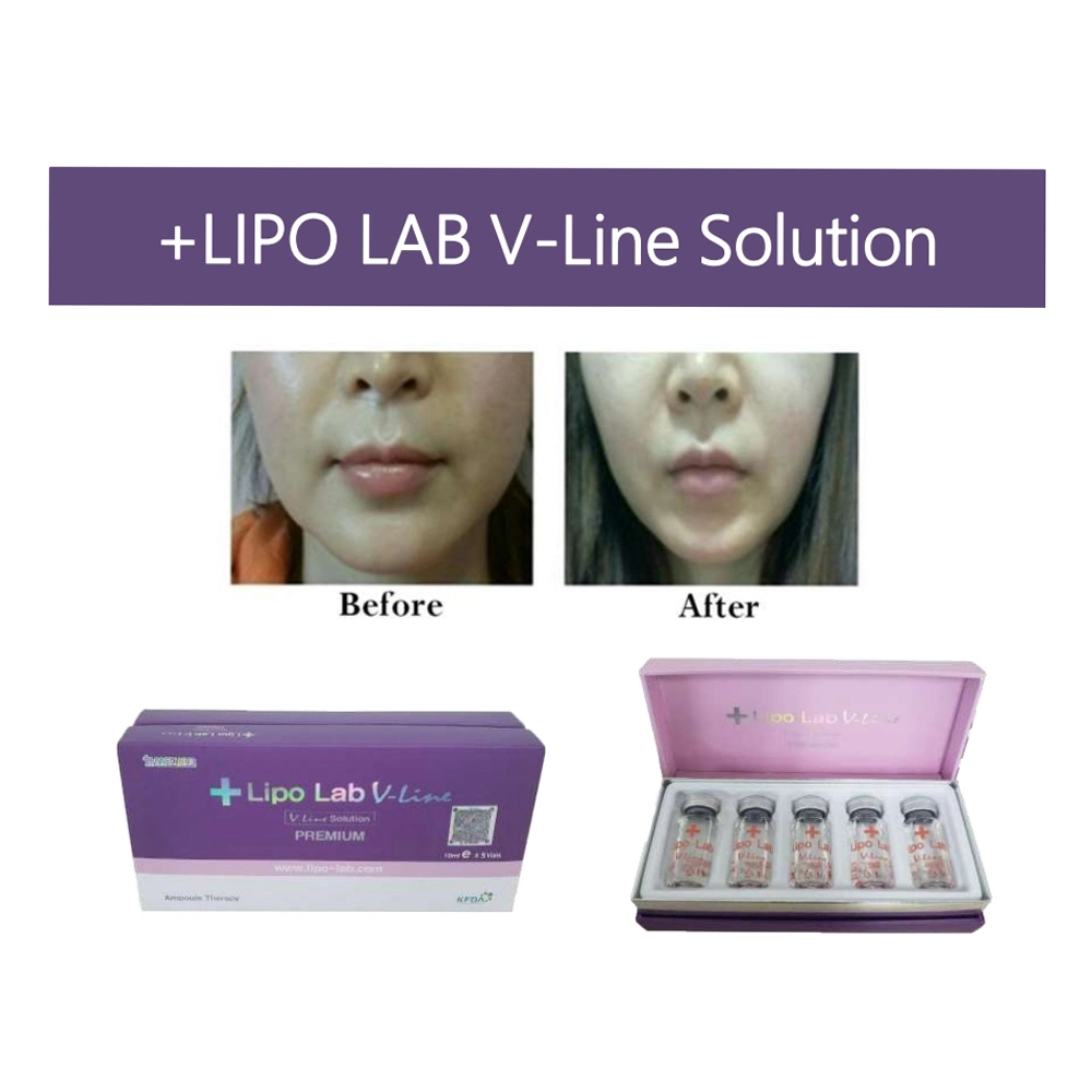 Strong Effect Lipo Lab Ppc Solution Lipo Lab Kybella Lipo Lab Dissolve Fat and Lose Weight Solution Serum