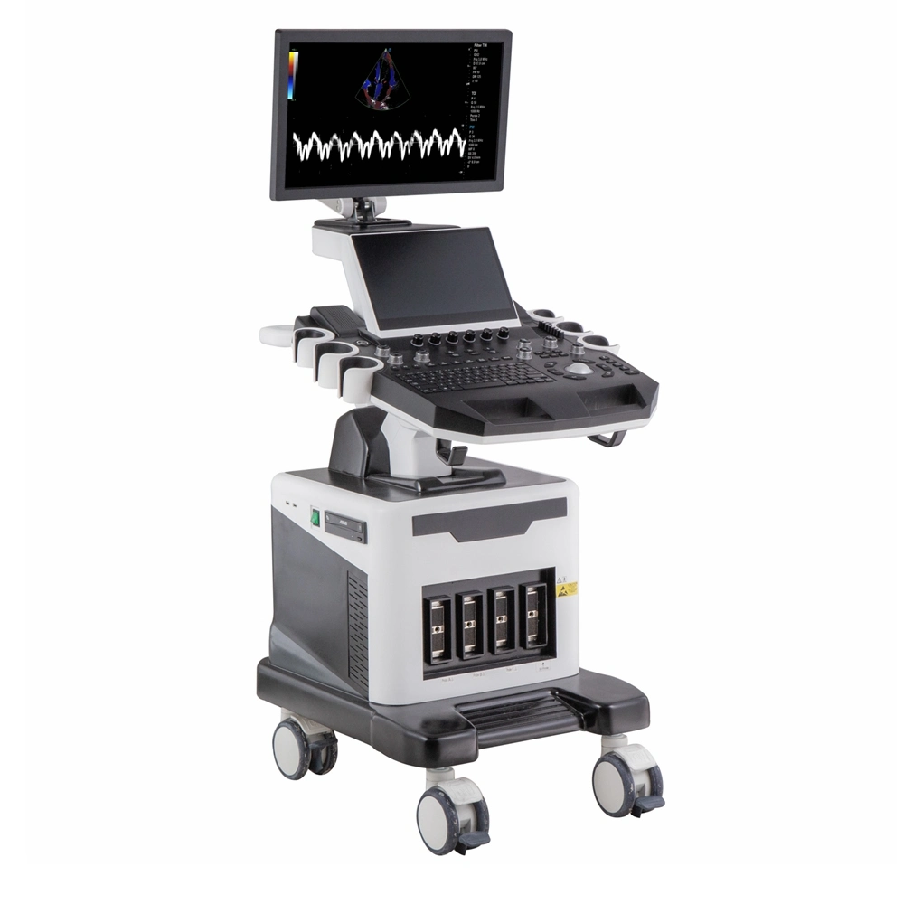 Hospital Equipment High End 4D/5D Mobile Trolley Color Doppler Ultrasound Machine for Ob&Gyn