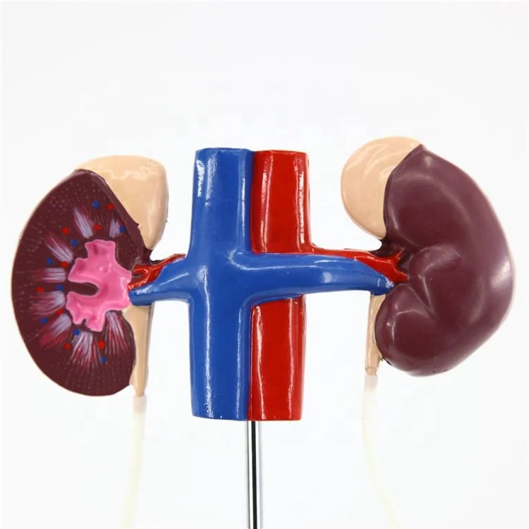 High Reproduction and Accuracy Medical Teaching Models Model of Female Urinary System