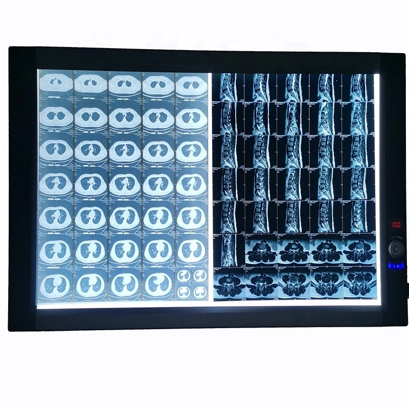 Visualizador de filmes de raios x médicos LED / filme de raios x Iluminador de equipamentos de raios X Médicos e acessórios para Classe I