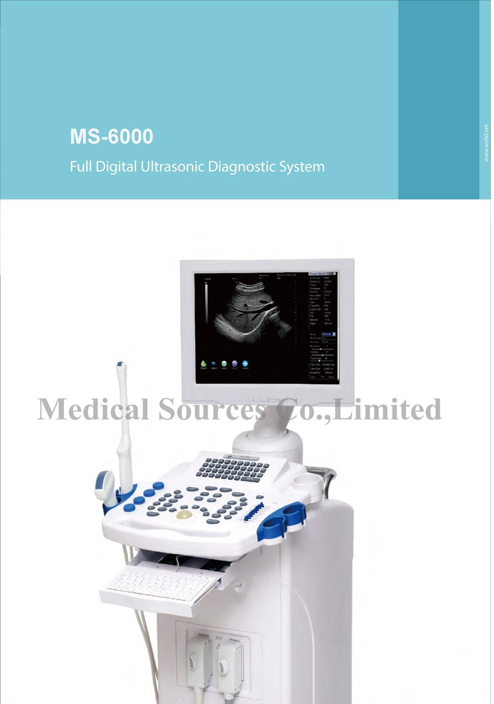 Ms-6000 Medical Ultrasound Device Digital Ultrasound Machine Doppler Ultrasound Scanner