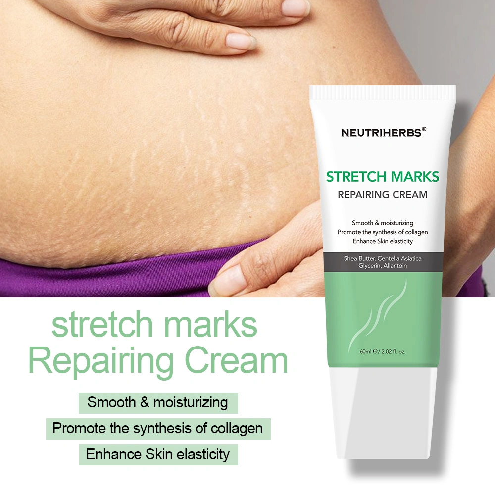 Private Label Remove Stretch Marks Repairing Smooothing Skin Stretch Mark Cream