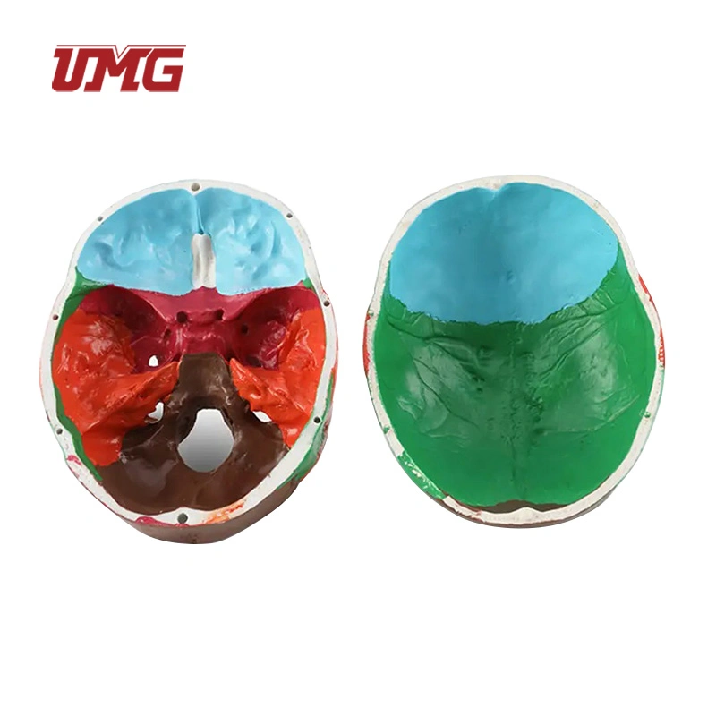 Colorful Skull Model Anatomical with Titanium Plate for Medical Training