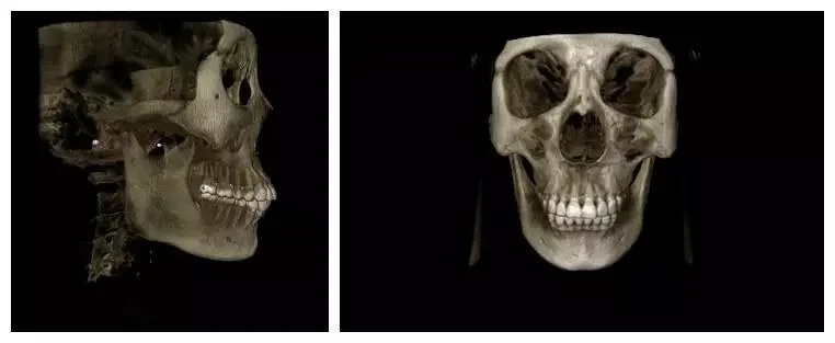 Máquina de rayos X digitales en la India Precio máquina de rayos X dentales Rayos X de Digital Equipment Medical Cámara móvil proveedor de sistemas de rayos x