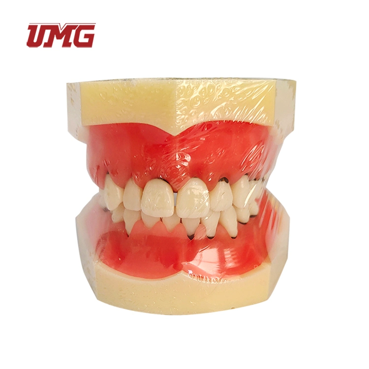 Goma macio amovível de Ensino Odontológico Modelo Periodontal o Jogo de Garras Inferior Superior