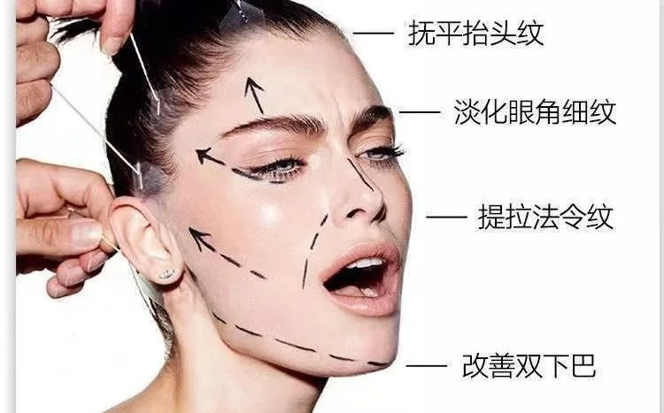 Parche de elevación de la cara de 40 equipos de elevación de adelgazamiento Anti-Wrinkle Eye Facial Lifting facial Band