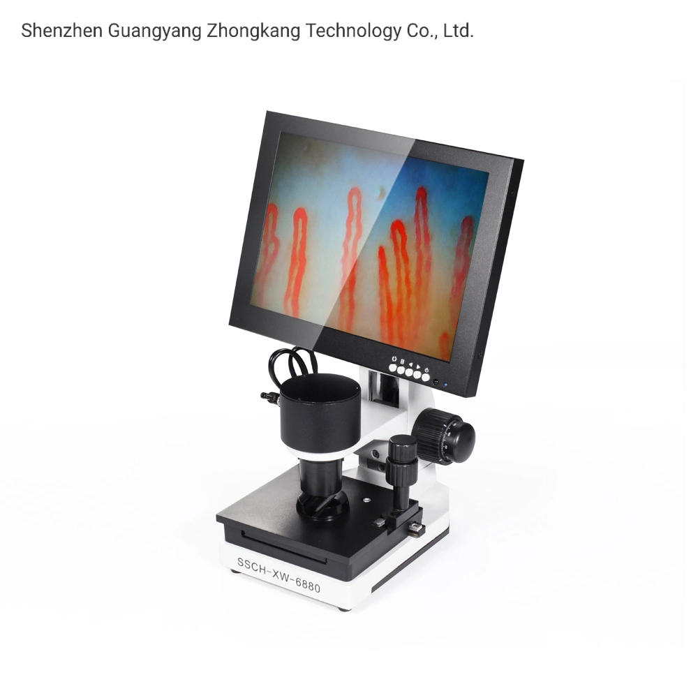 Portable 10 Inch Noninvasive Blood Capillary Microcirculation Microscope