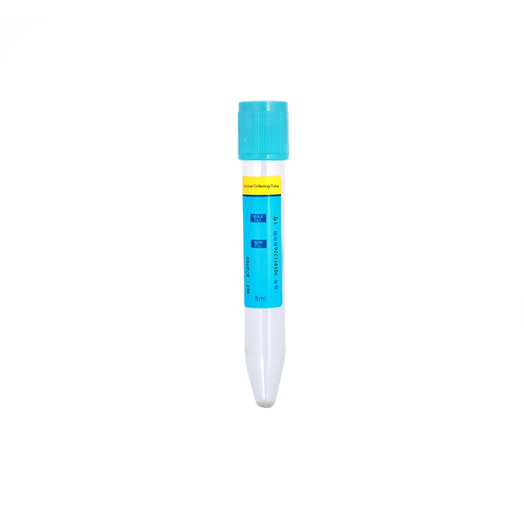 Medical Grade Plastic Material Vacuum Urine Tube Urine Container