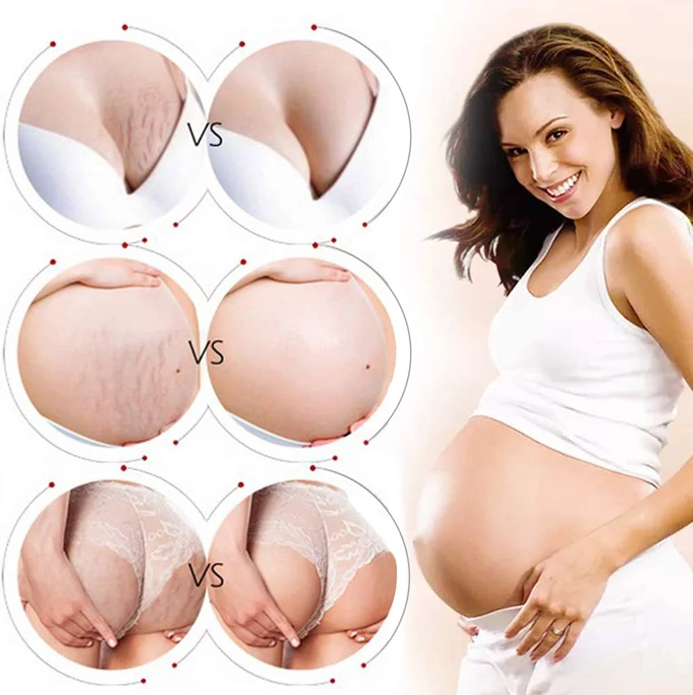 Wholesale/Supplier Scar Post-Natal Repair and Anti-Obesity Growth Lines and Pregnancy Lines Repair Cream